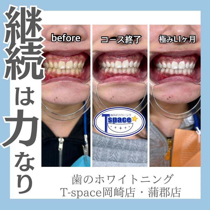 画像662