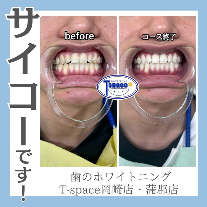 画像670