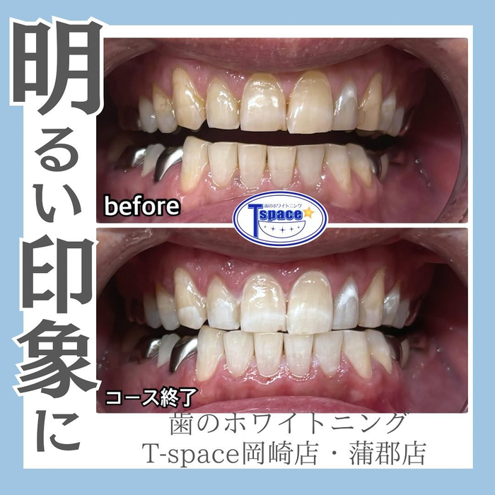 画像687