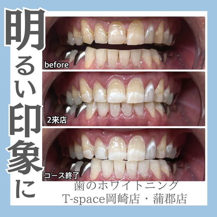 画像688