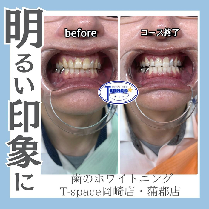 画像689