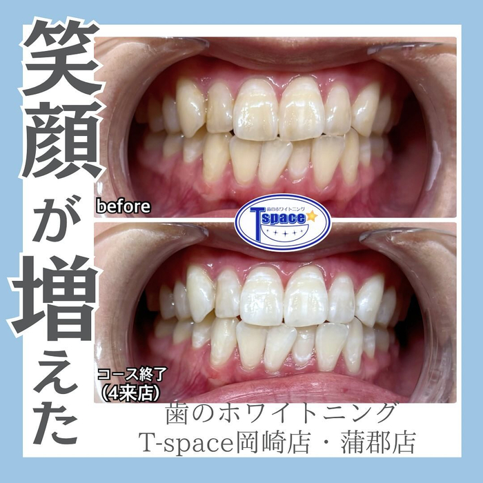 画像697