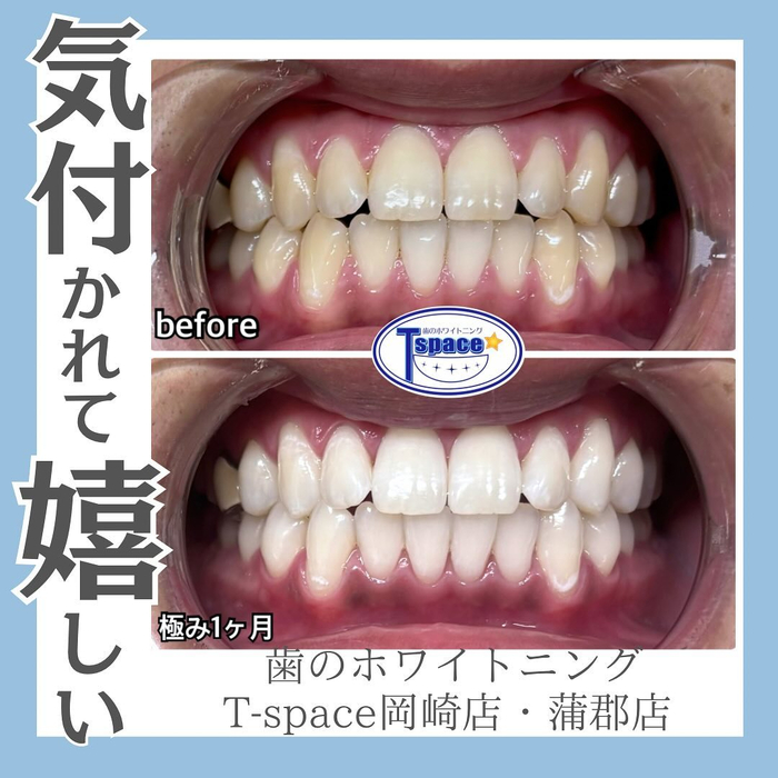 画像715