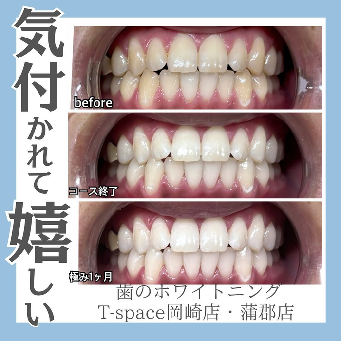 画像716