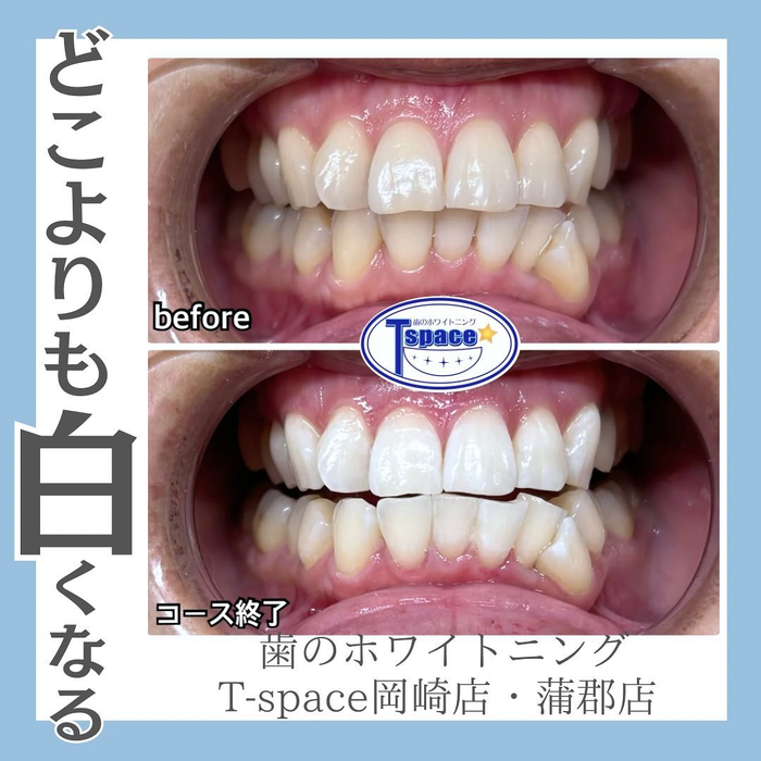 画像723