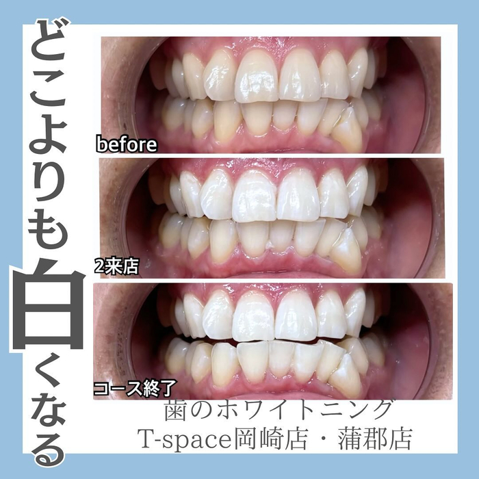 画像724