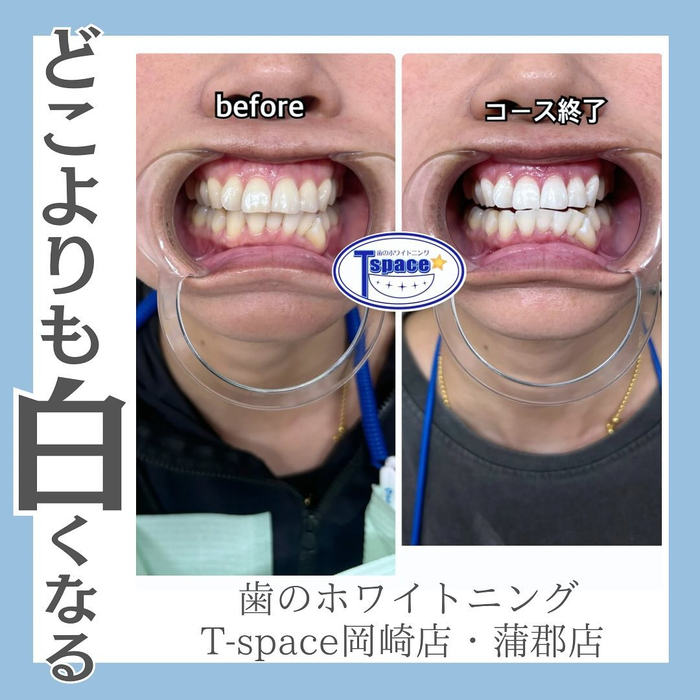 画像725