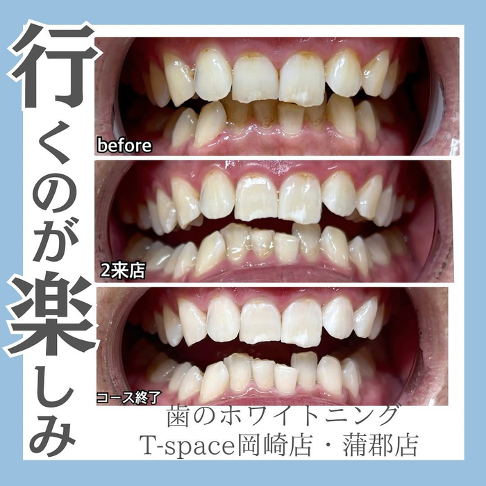 画像734
