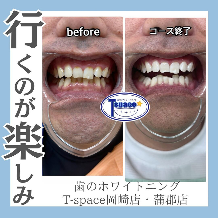 画像735