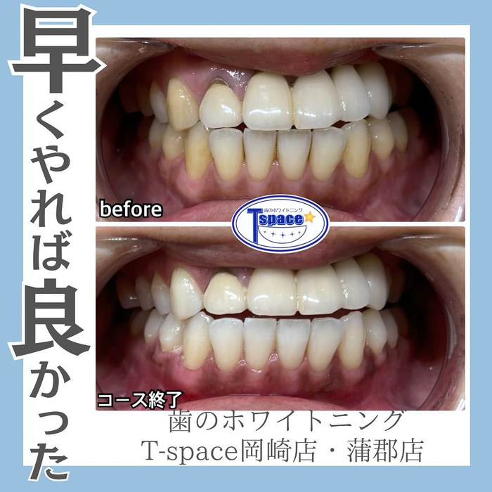 画像741