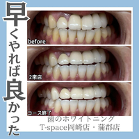 画像742