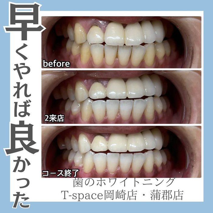 画像742