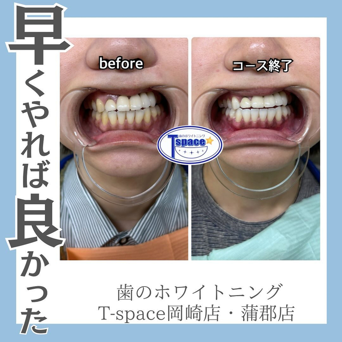 画像743