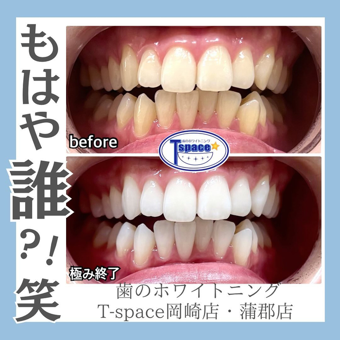 画像751