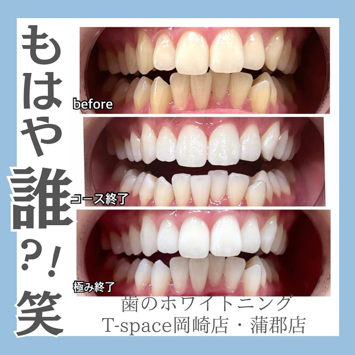 画像752