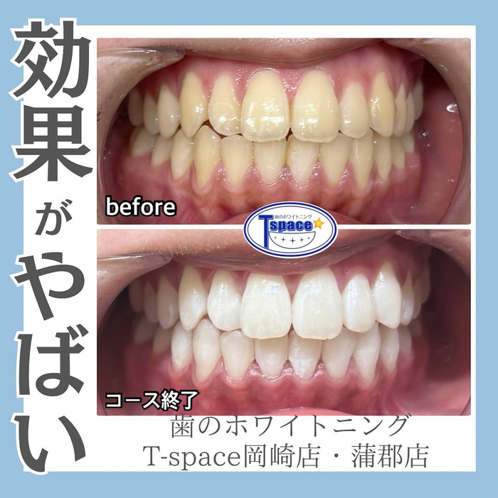 画像761