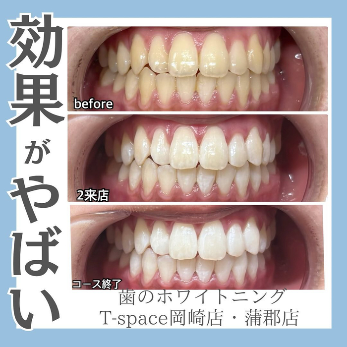 画像762