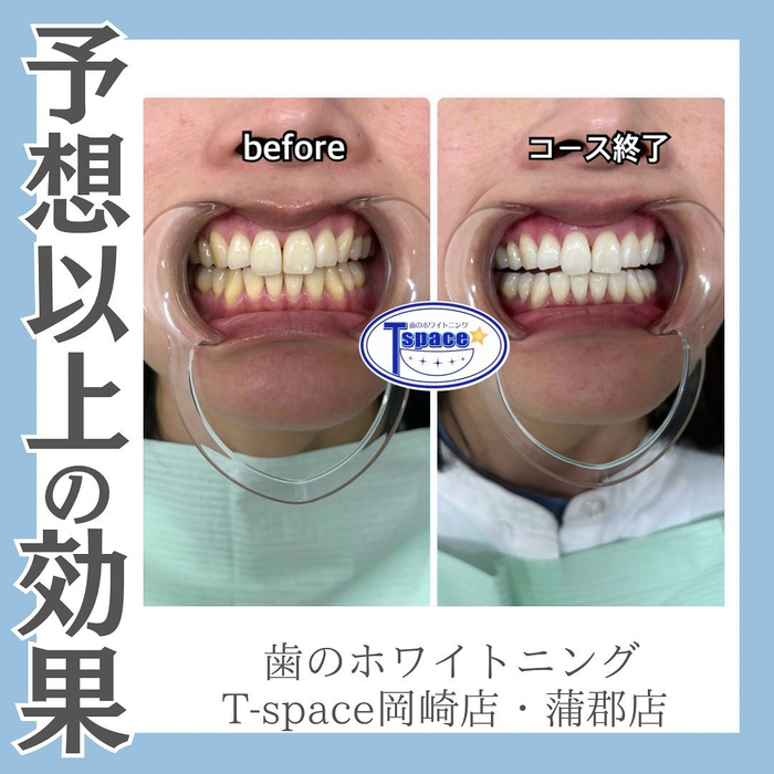 画像772