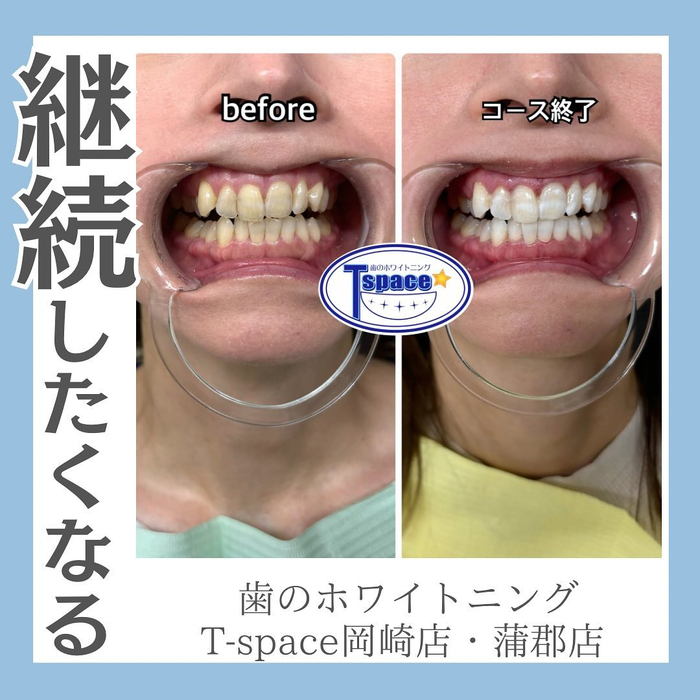 画像782