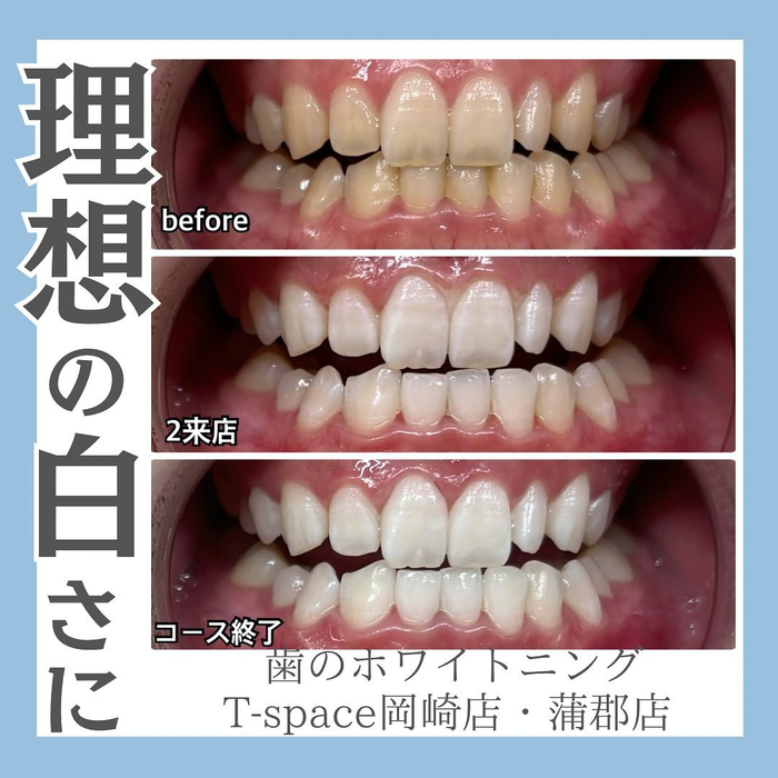 画像791