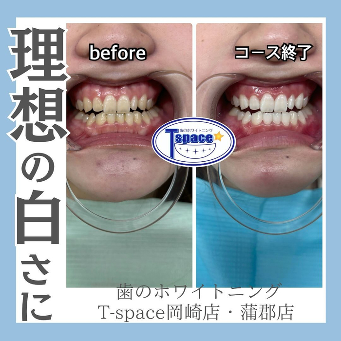 画像792