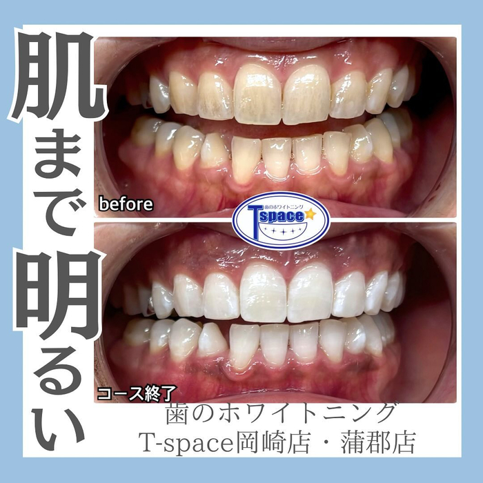 画像810