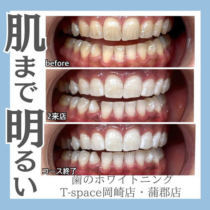 画像811