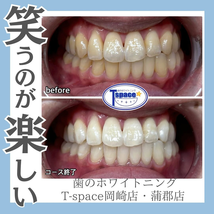 画像819