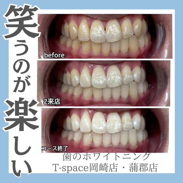 画像820