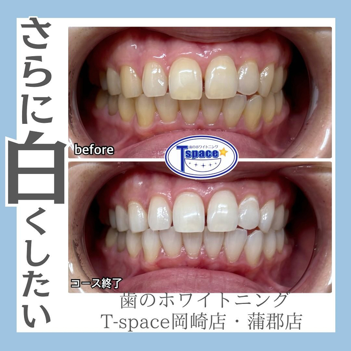 画像829