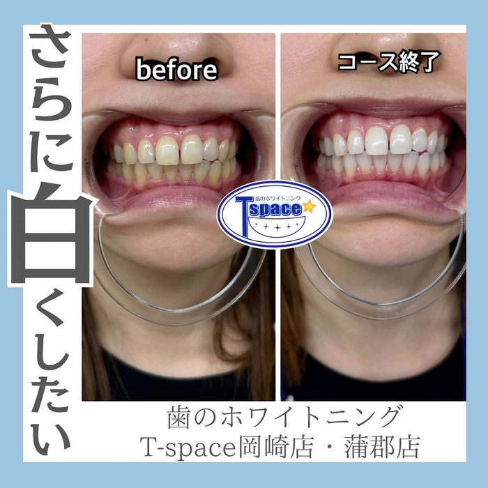 画像831