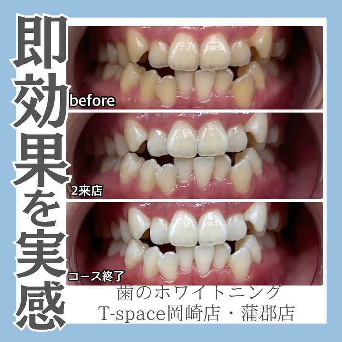 画像838