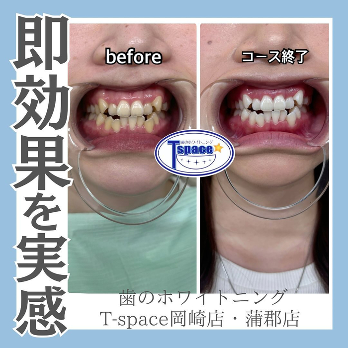画像839