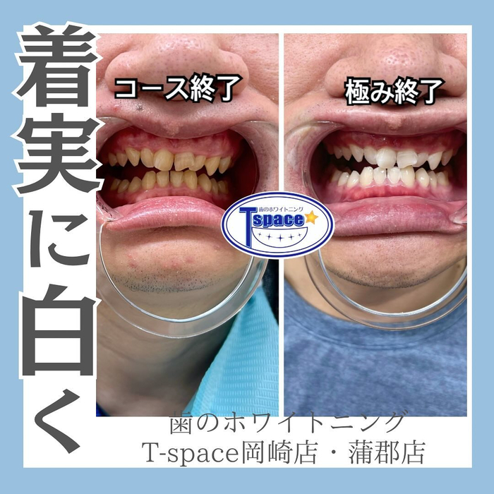 画像849