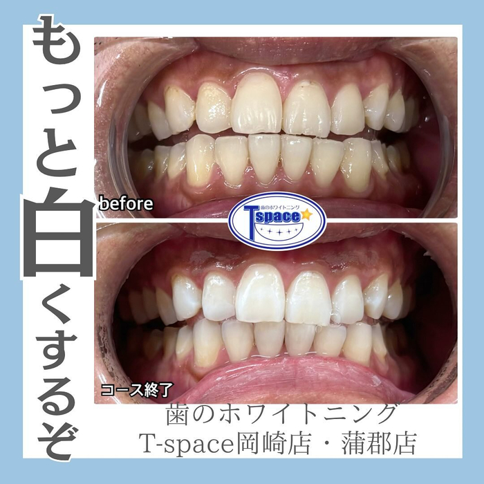 画像855