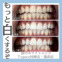 画像856