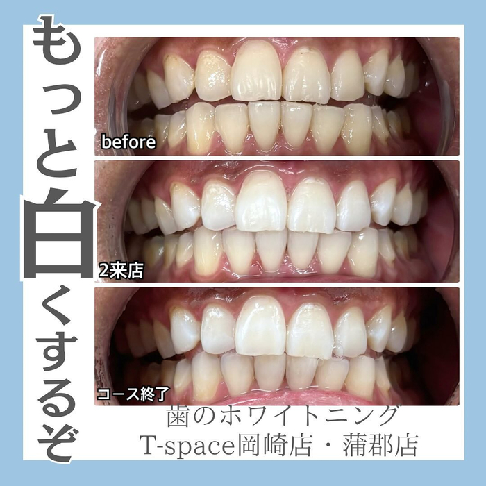 画像856