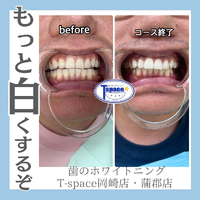 画像857