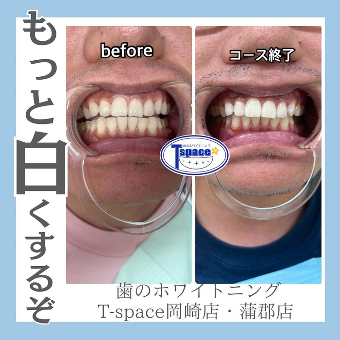 画像857