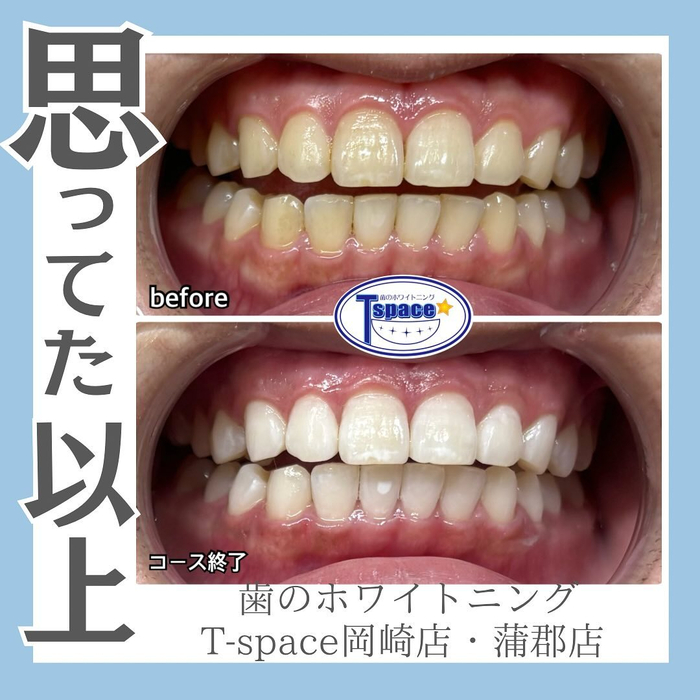 画像865