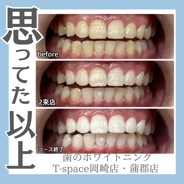 画像866