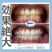 画像875
