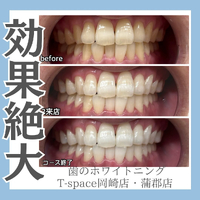 画像876
