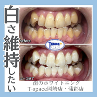 画像884