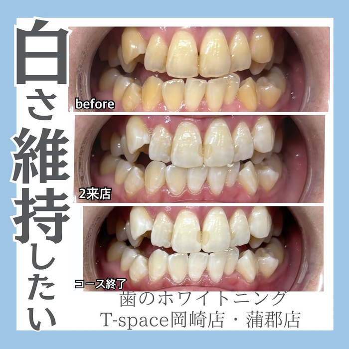 画像885