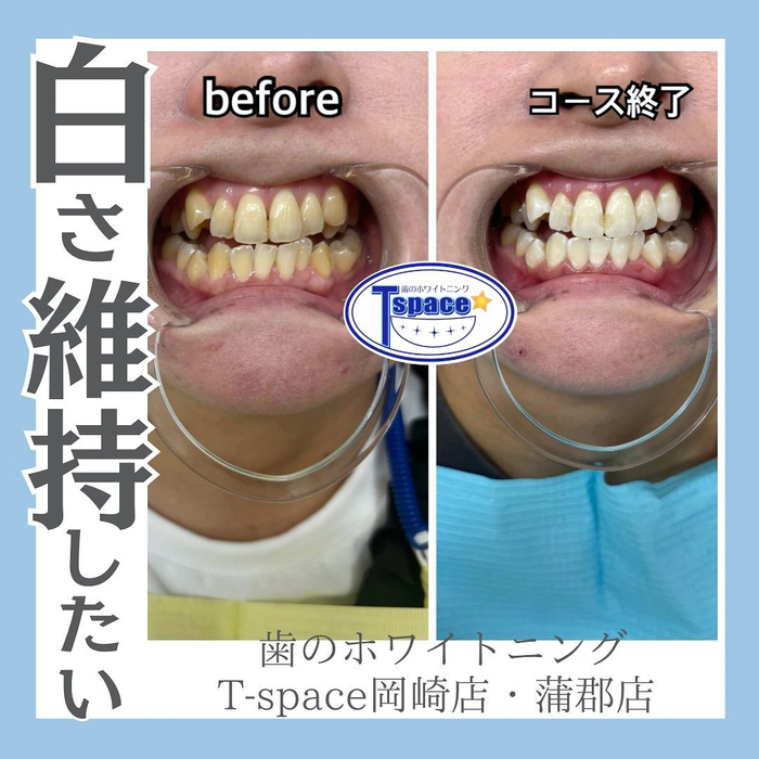 画像886