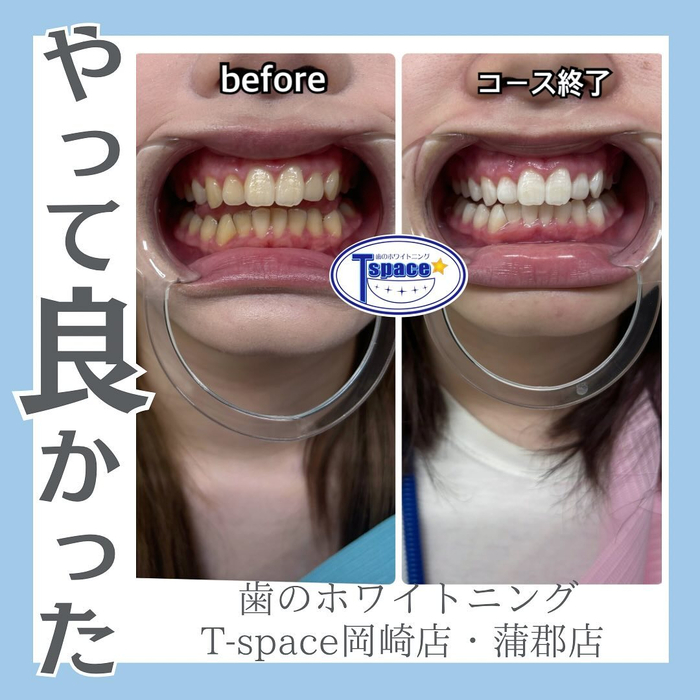 画像920