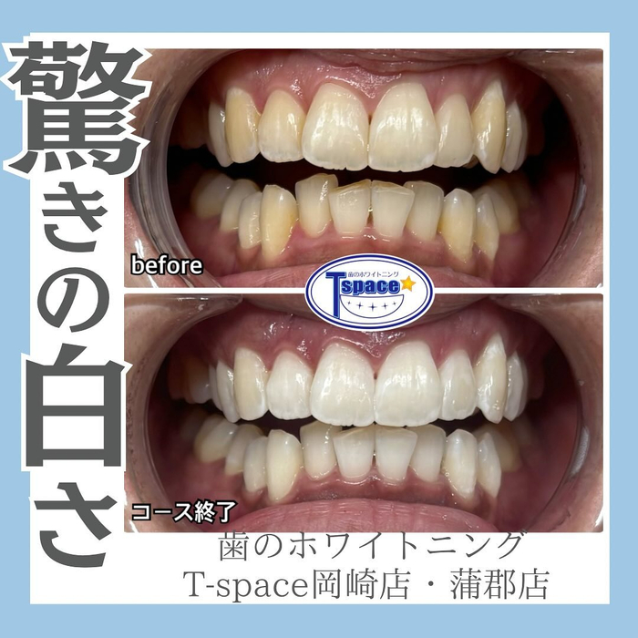 画像928