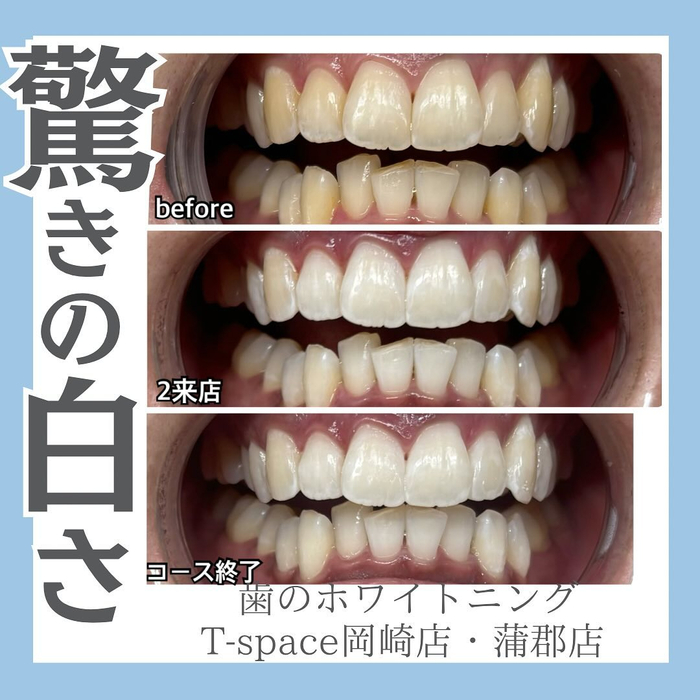 画像929