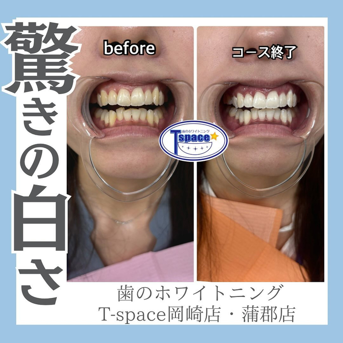 画像930
